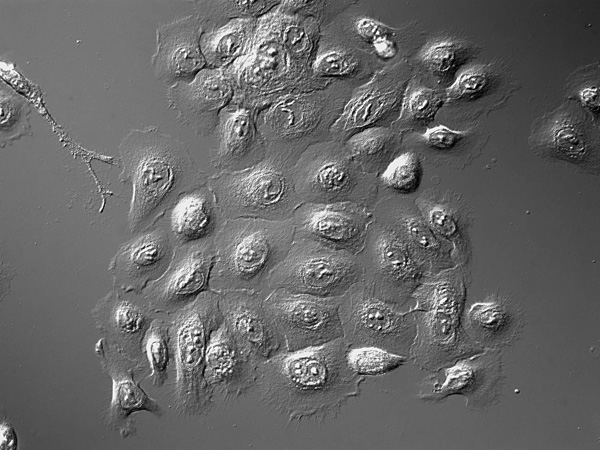 Photo from a microscope: a group of amorphous cells stuck together