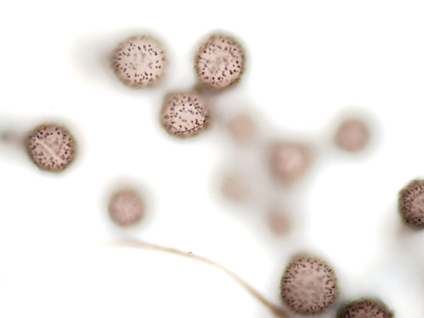 White spherical structures with dark spots on a luminous white background