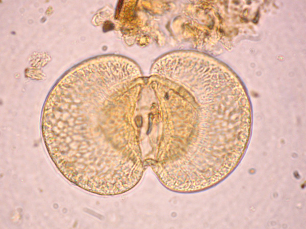 A pollen grain seen under the microscope. It is round, with two flat structures on the sides that resemble wings