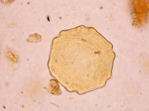 A pollen grain seen under the microscope. It is slightly angular, polyhedral