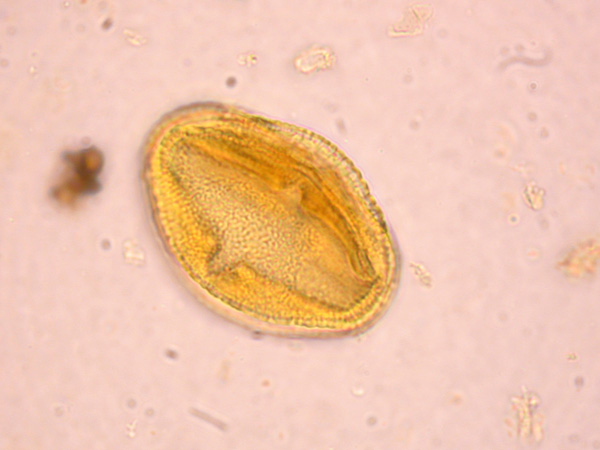 A pollen grain seen under the microscope. It resembles a rugby ball