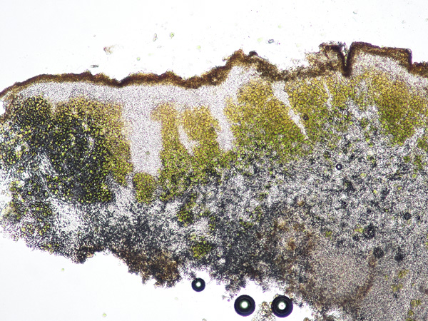 Cell layers seen under a microscope: thin, brown on top, green in the middle and grey on the bottom