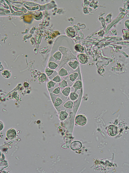Seen under a microscope, a transparent, sac-like structure filled with greenish grains