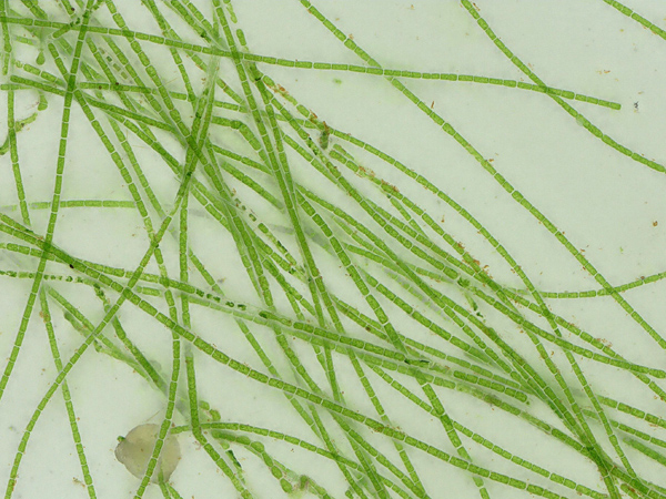 Seen under a microscope, a tangle of green, thread-like structures. Each thread is made up of many segments-cells
