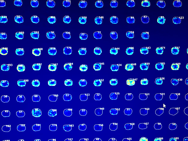 Numbered digital images of circular cross-sections displayed on the monitor in rows. They differ in light intensity