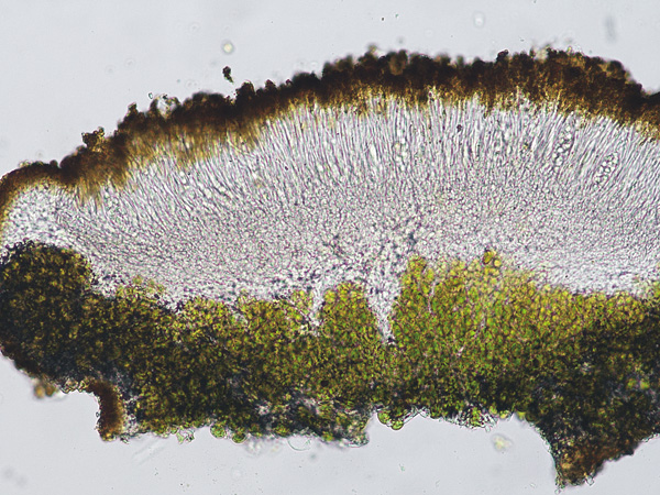 Microscopic cross-section showing three layers of cells: the upper - brown, the middle - transparent and the lower - green