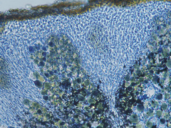 Blue-stained microscopic cross-section showing a layer of small cells and an underlying layer of large cells