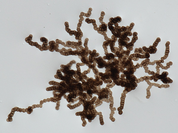 Seen under a microscope, a tangle of dark brown bead-like strings of spherical cells